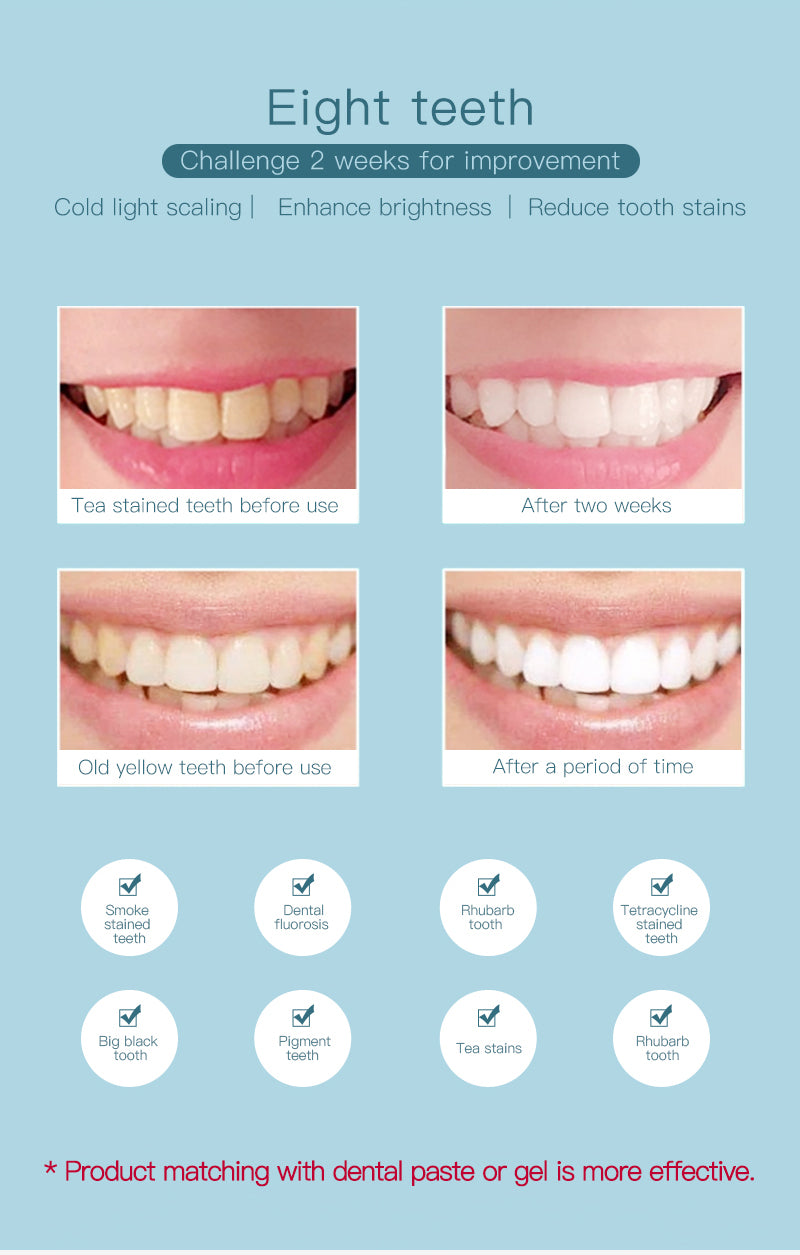 Dispositivo de branqueamento de dentes Escova de onda de 360 graus USB recarregável ultra-sônico U Forma inteligente automática Sonic escova de dentes elétrica